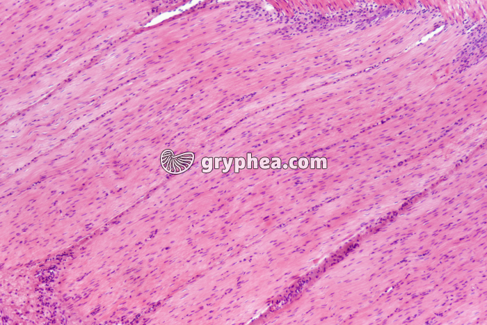 Fibres musculaires lisses x25 - gryphea.com